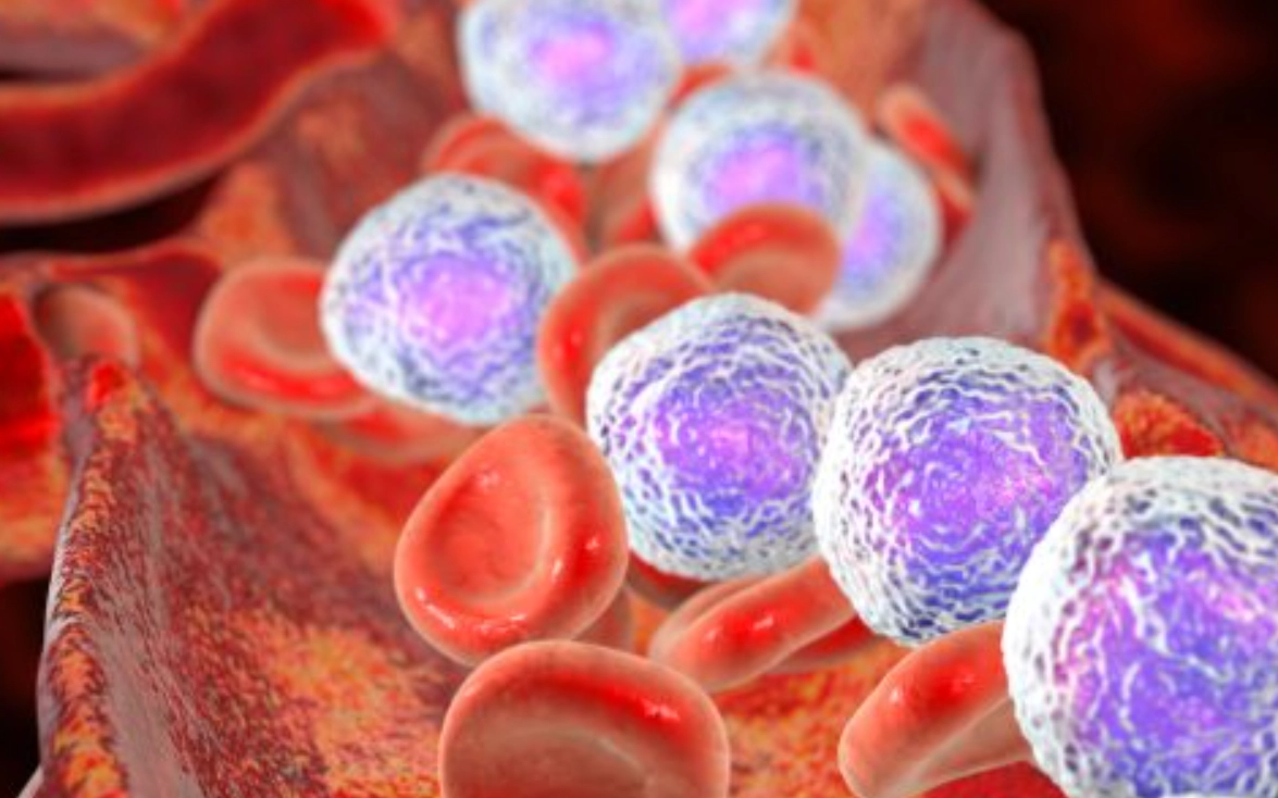 淋巴白血球低治療