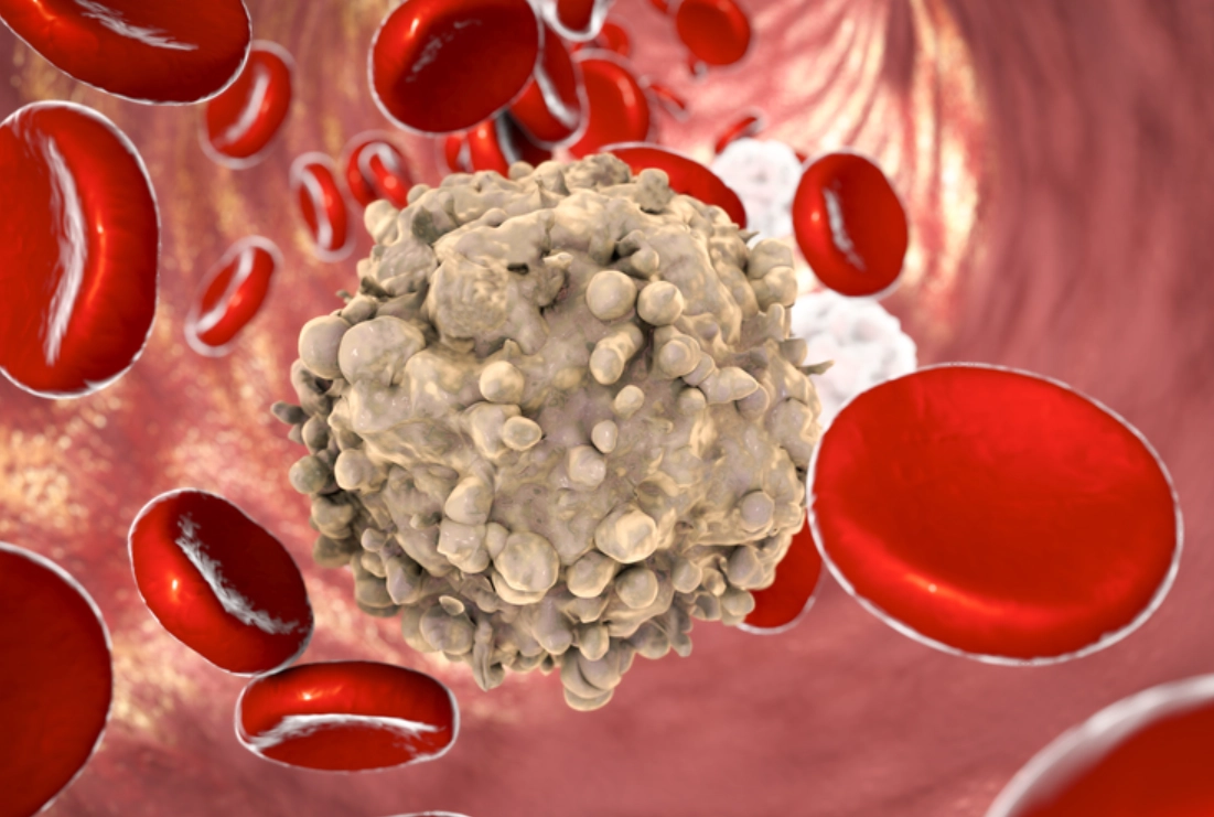 淋巴白血球低症狀