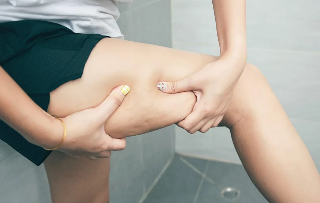 橫紋肌溶解症恢復時間