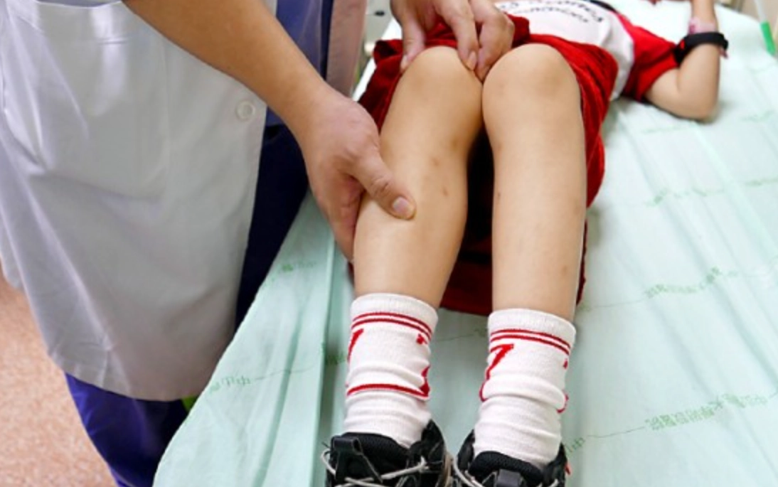 橫紋肌溶解症症狀