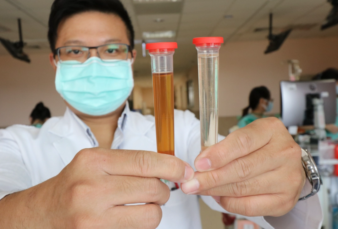 橫紋肌溶解症症狀全解析：識別警訊、處理步驟與預防關鍵