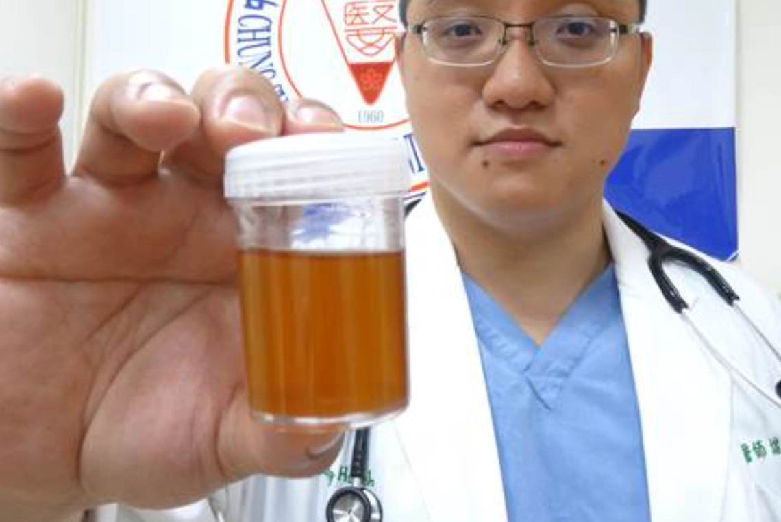 橫紋肌溶解症治療