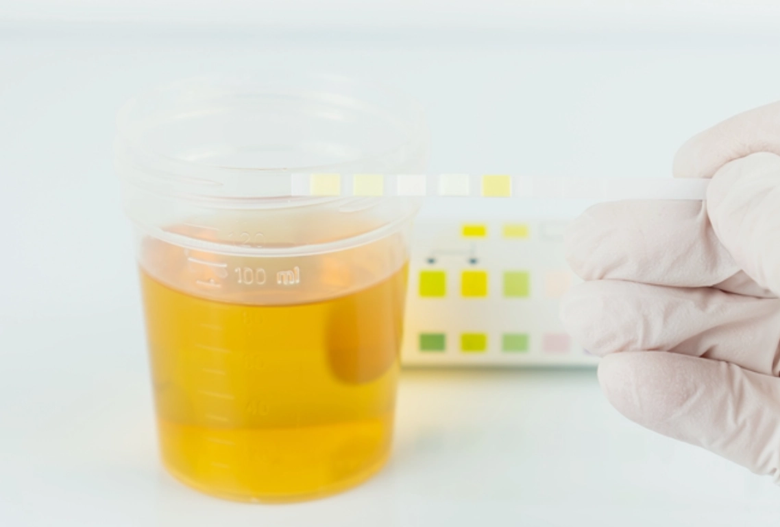 尿白血球過高的原因全解析：從感染到慢性病一次搞懂