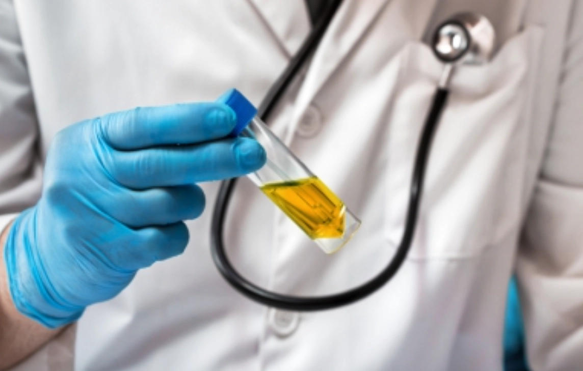 尿路感染症狀 尿路感染症狀