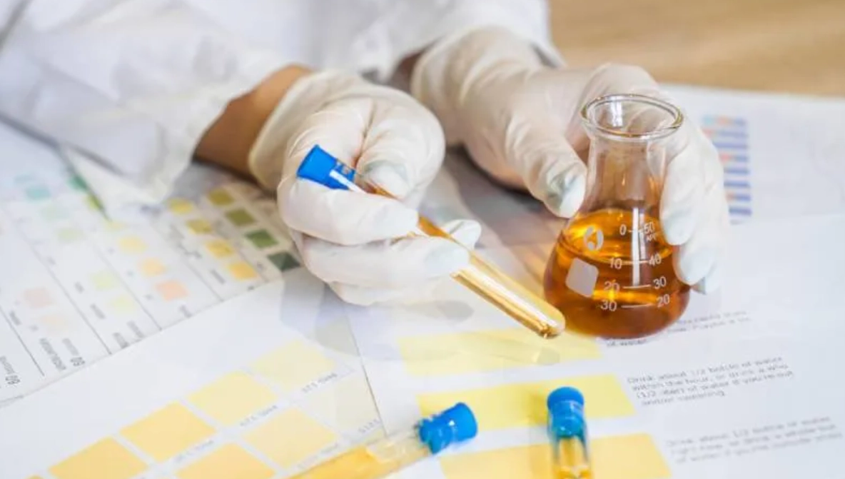 尿液白血球偏高 尿液白血球偏高