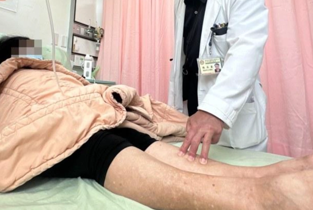 橫紋肌溶解症後遺症