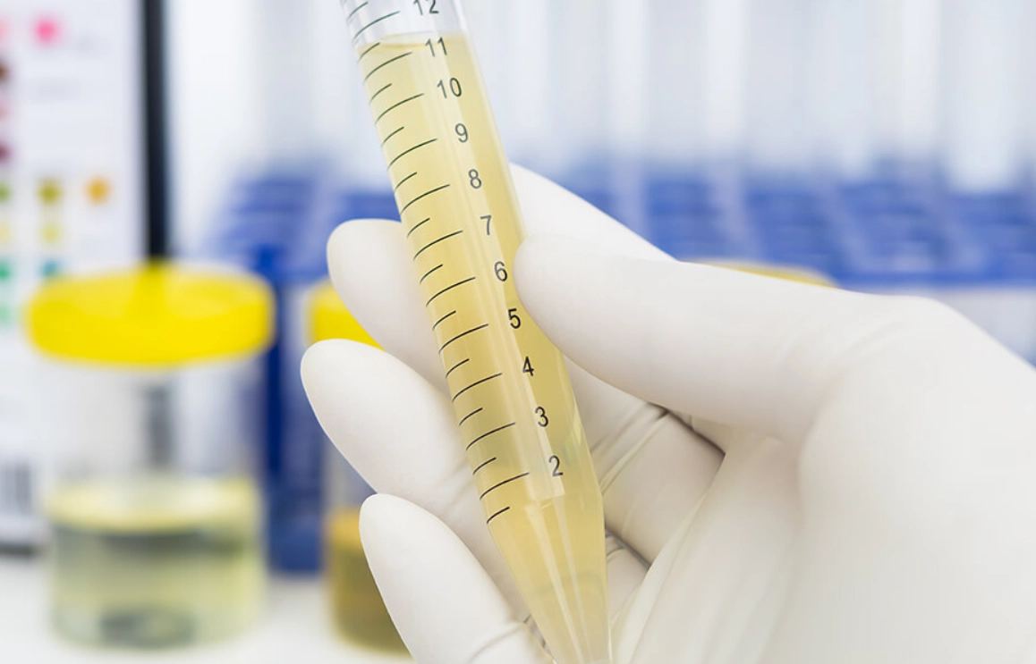 尿路感染症狀 尿路感染症狀