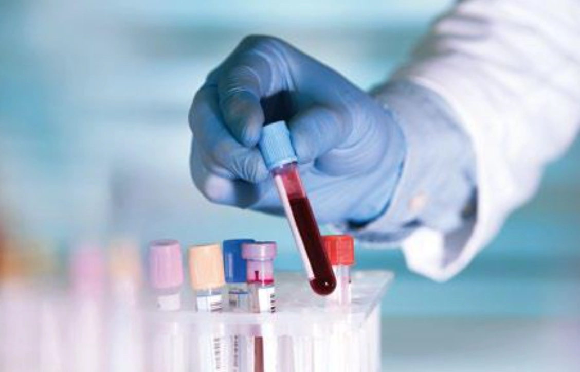 白血球偏低症狀