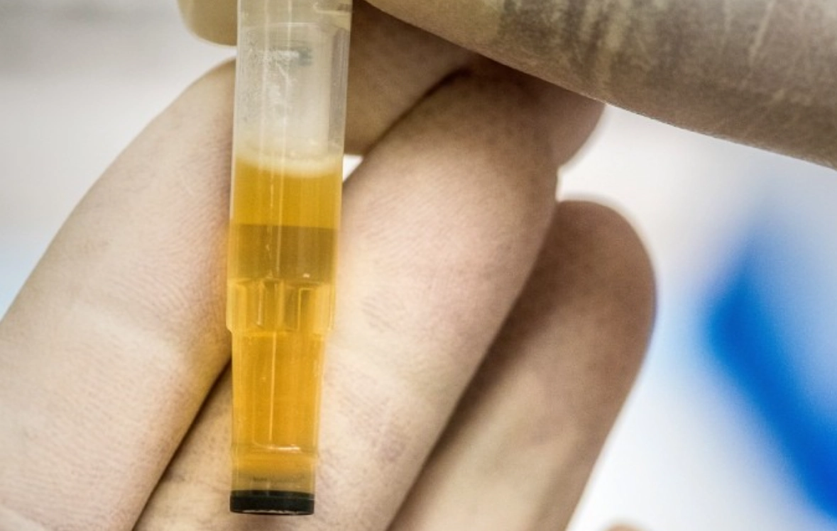 尿白血球過高原因 尿白血球過高原因