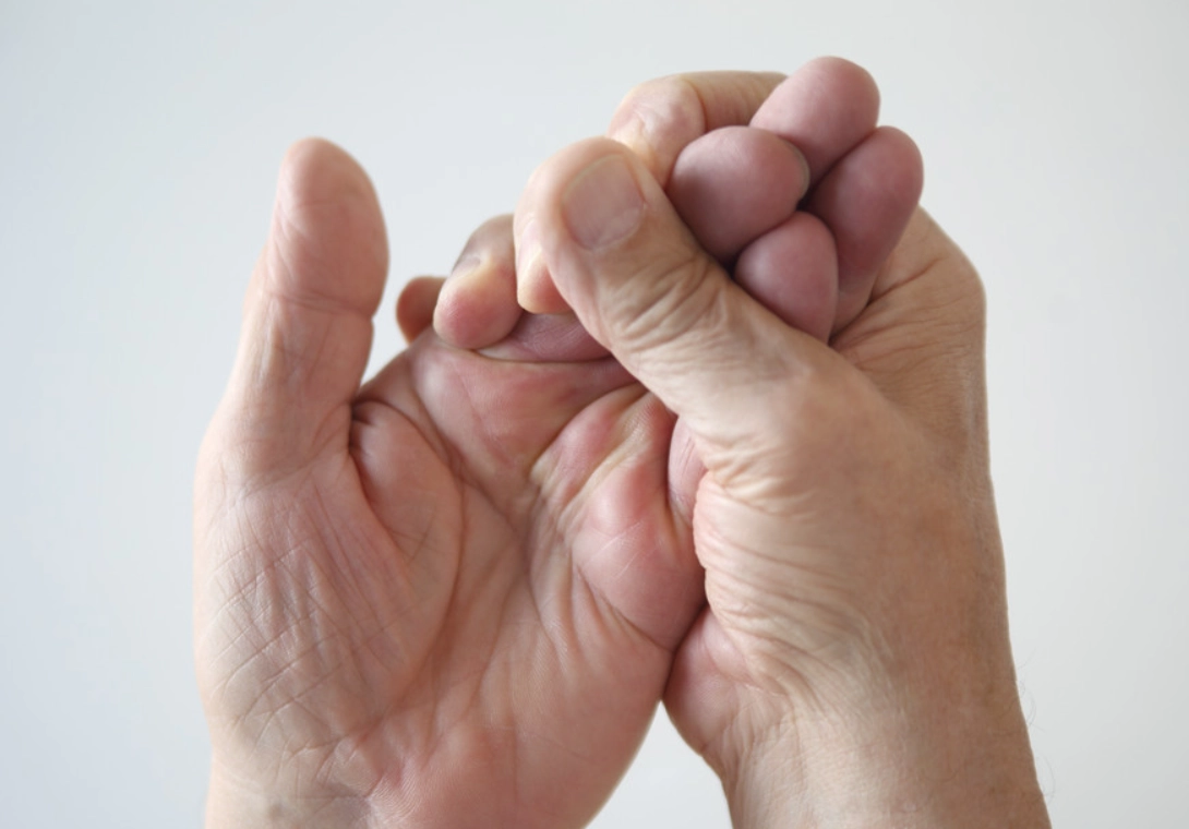 腕隧道症候群症狀 腕隧道症候群症狀