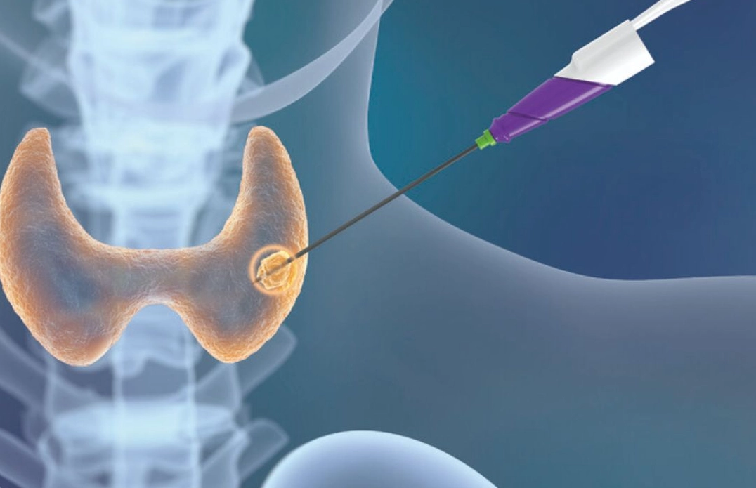 喉嚨沙啞治療方法