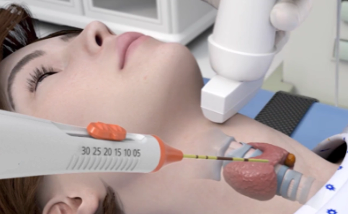 喉嚨沙啞治療方法