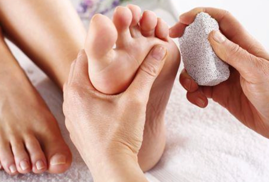 快速去除腳皮：安全有效的居家護理步驟與專家避坑指南