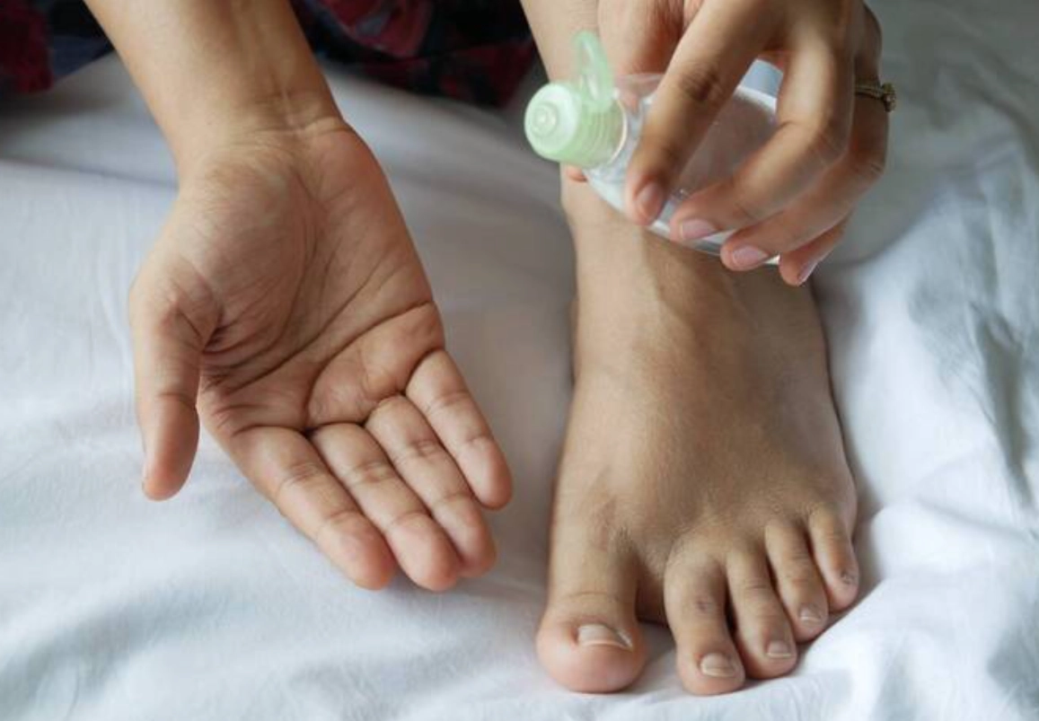 腳脫皮藥膏 腳脫皮藥膏