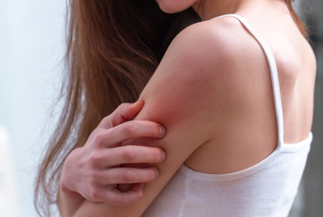 夜晚皮膚癢原因 夜晚皮膚癢原因