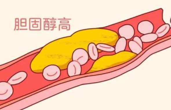 降低膽固醇方法 降低膽固醇方法