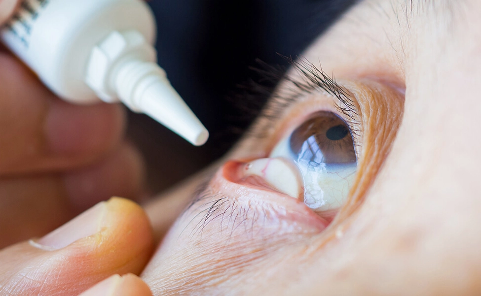 眼藥水使用步驟