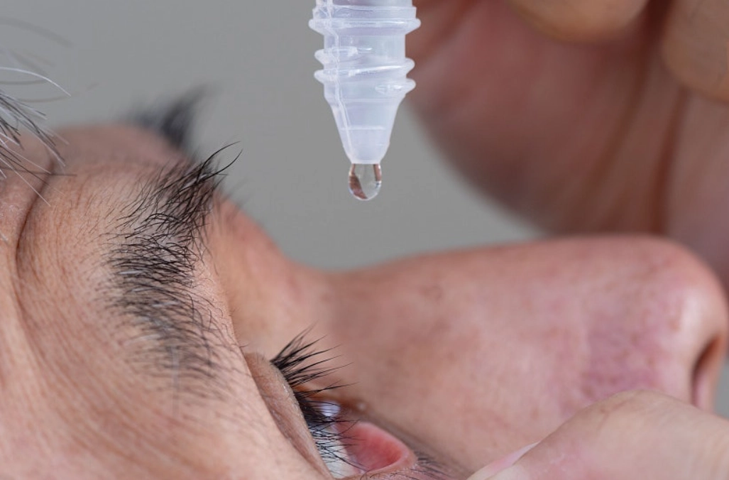 正確點眼藥水方法