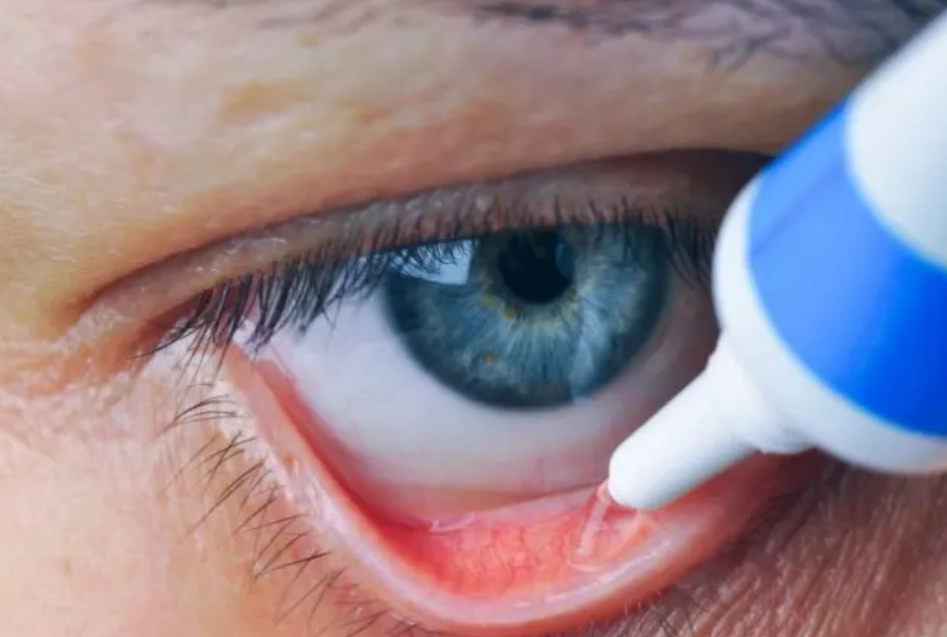 眼藥膏使用技巧