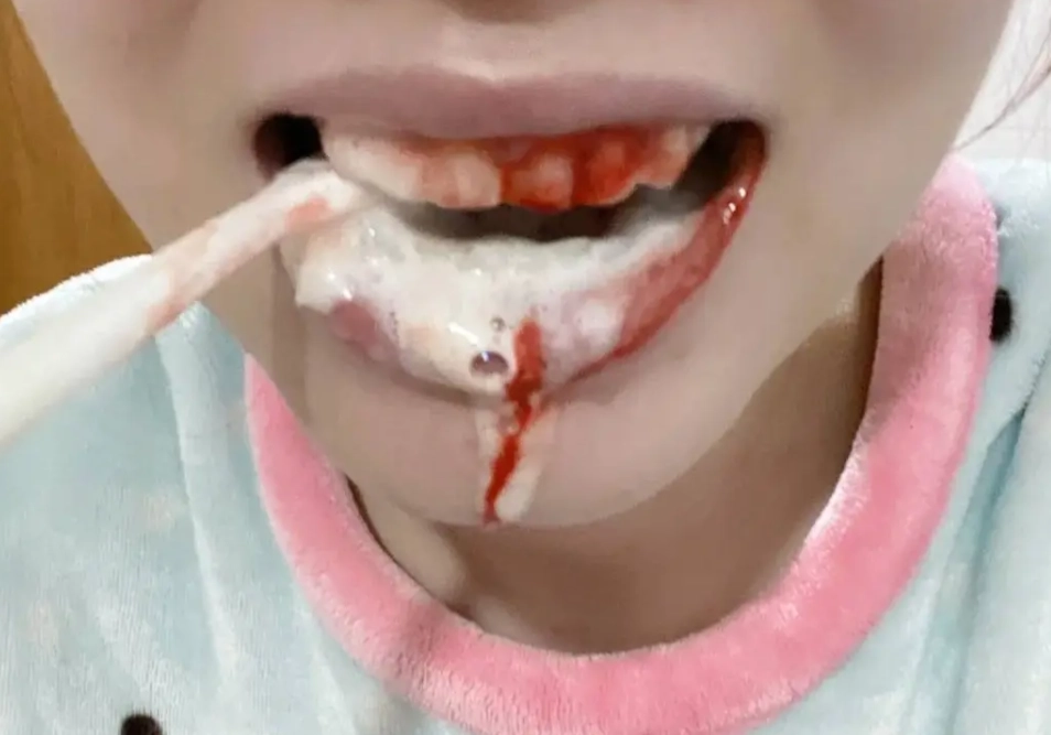 刷牙流血處理