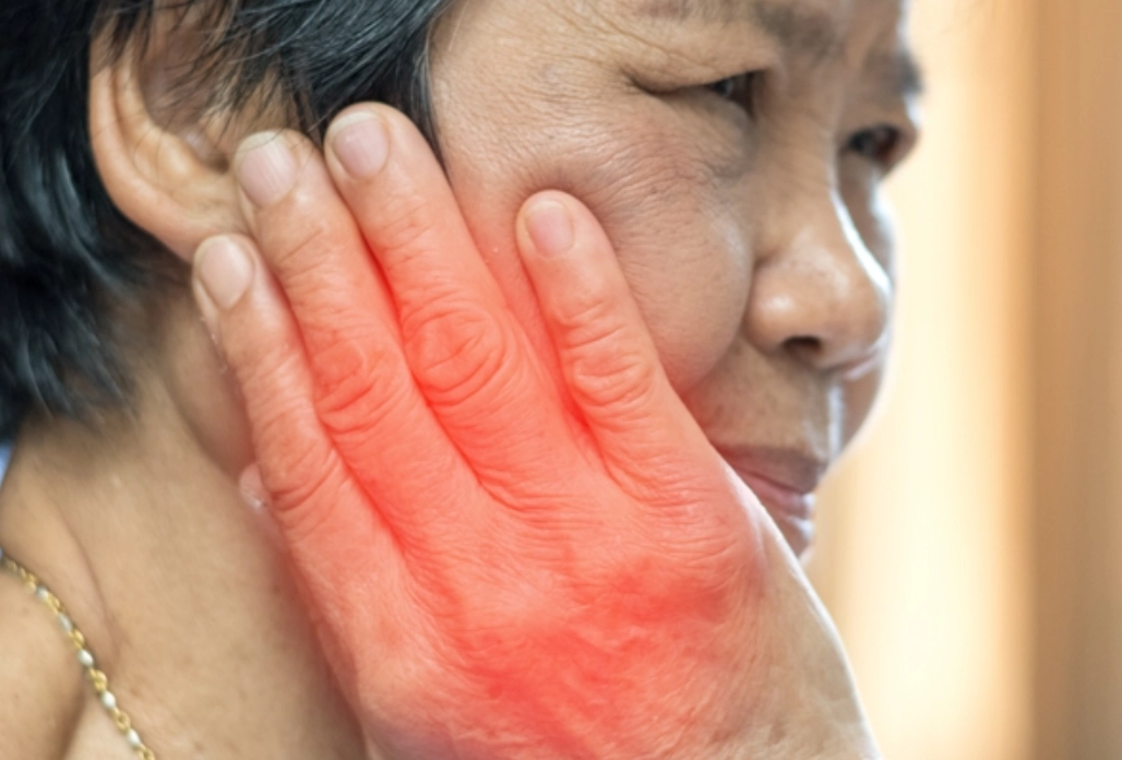 臉部麻木看哪科