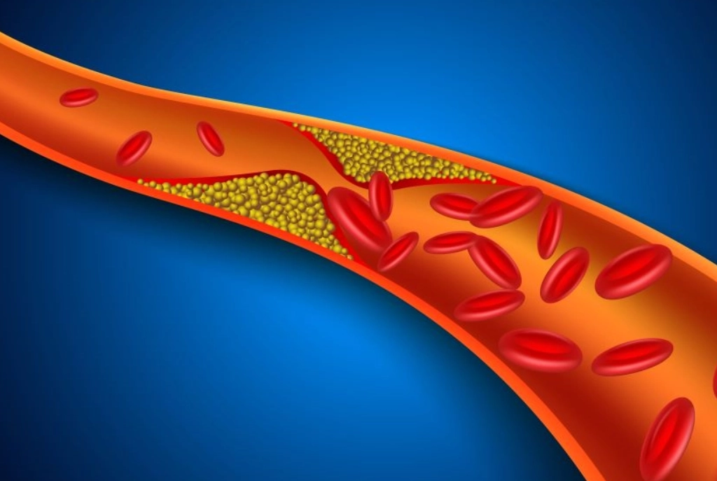 膽固醇壞處 膽固醇壞處