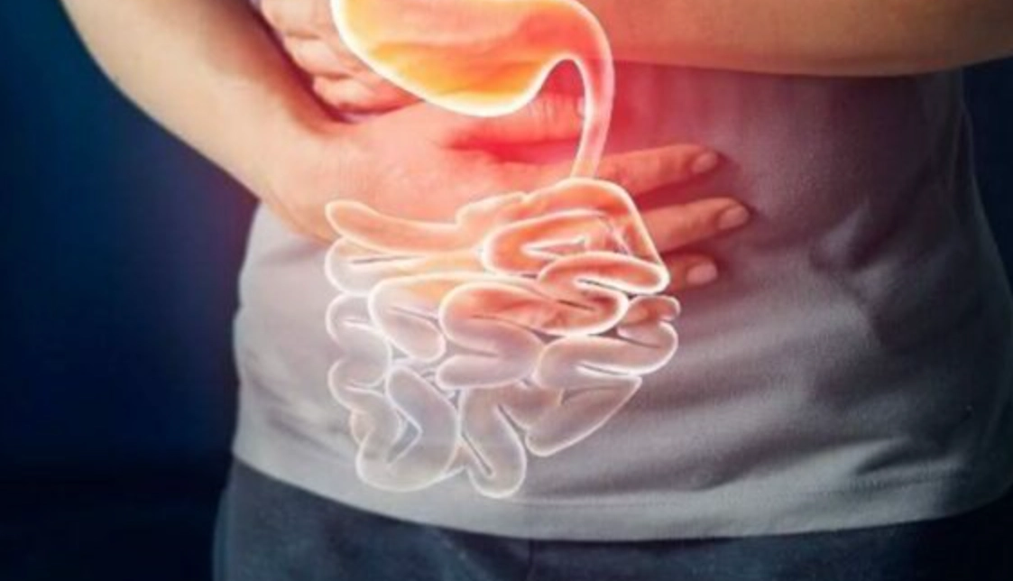 肚子脹氣如何消除