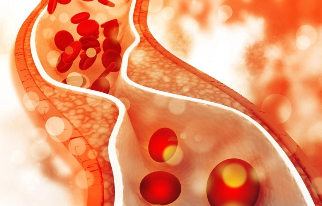 降低膽固醇方法 降低膽固醇方法