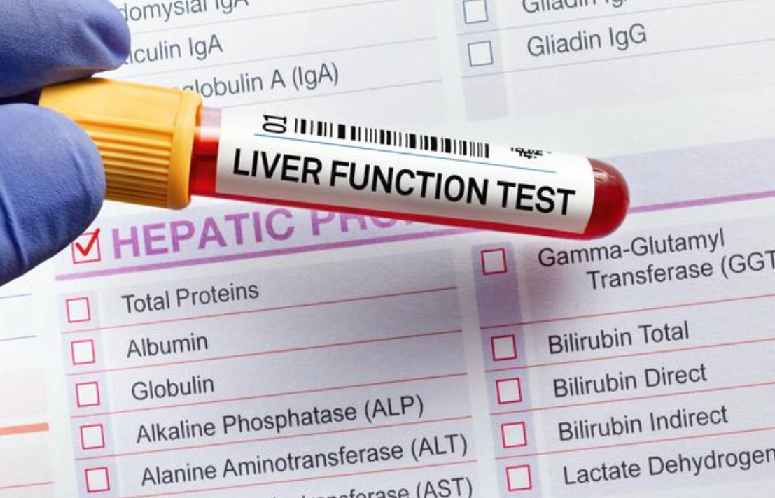 如何降低膽紅素