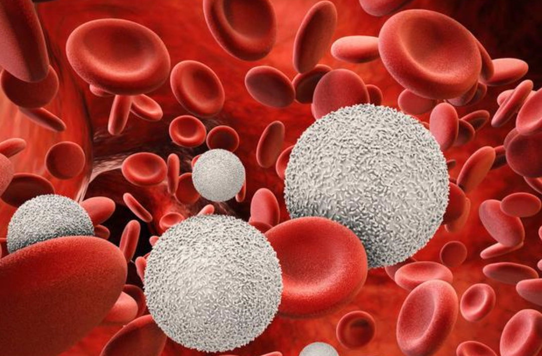 膽紅素偏高飲食