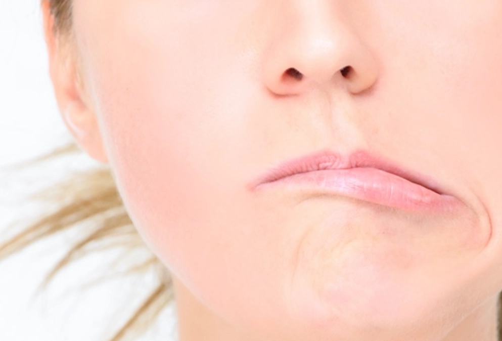 顏面神經失調舌頭麻